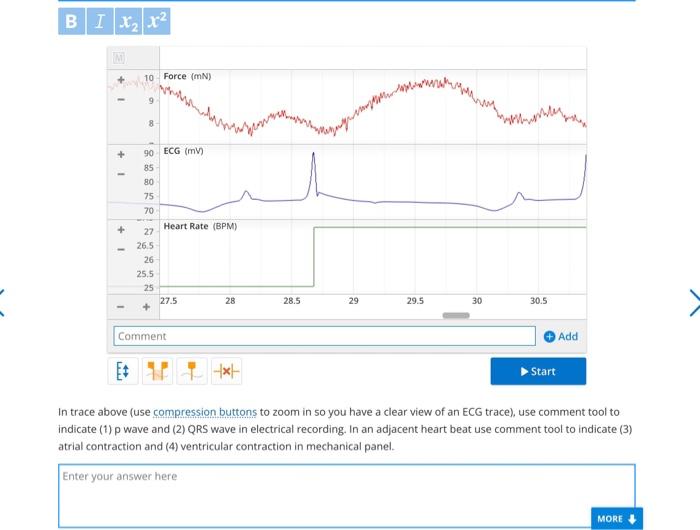 n trace above (use compression buttons to zoom in so | Chegg.com