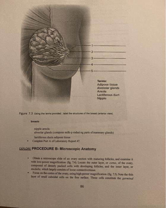 Solved Ovary Uhart tube Ovarta ligament Primordial folicies