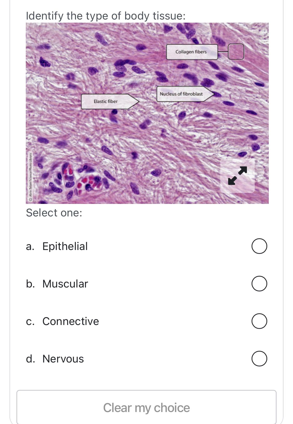 Solved Identify The Type Of Body Tissue:Select One:a. | Chegg.com