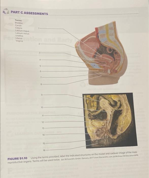 Solved PART C ASSESSMENTS Terms: Bladder Cervix Clitoris | Chegg.com