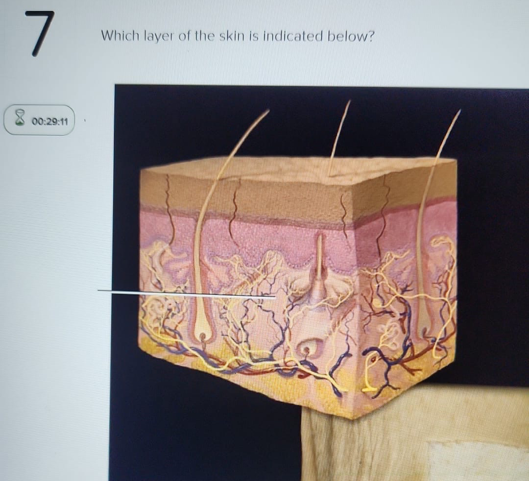 Solved Which layer of the skin is indicated below? | Chegg.com