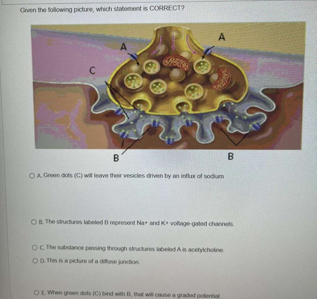 Solved Given the following picture, which statement is | Chegg.com