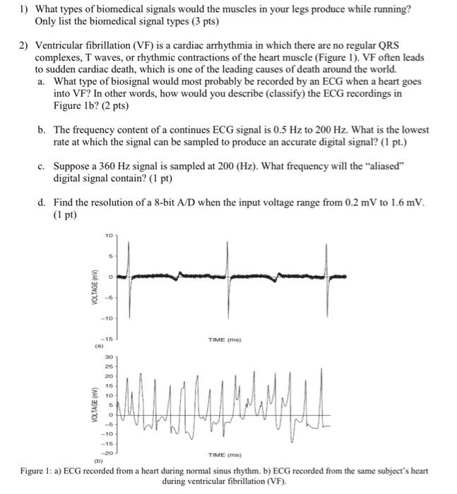 Solved 1) What types of biomedical signals would the muscles | Chegg.com