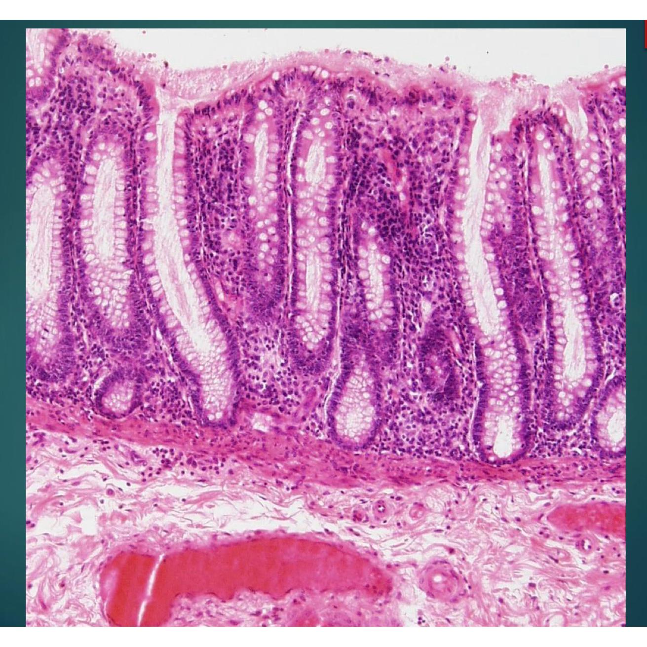 Solved What is this organ in histology . Biology Diagrams