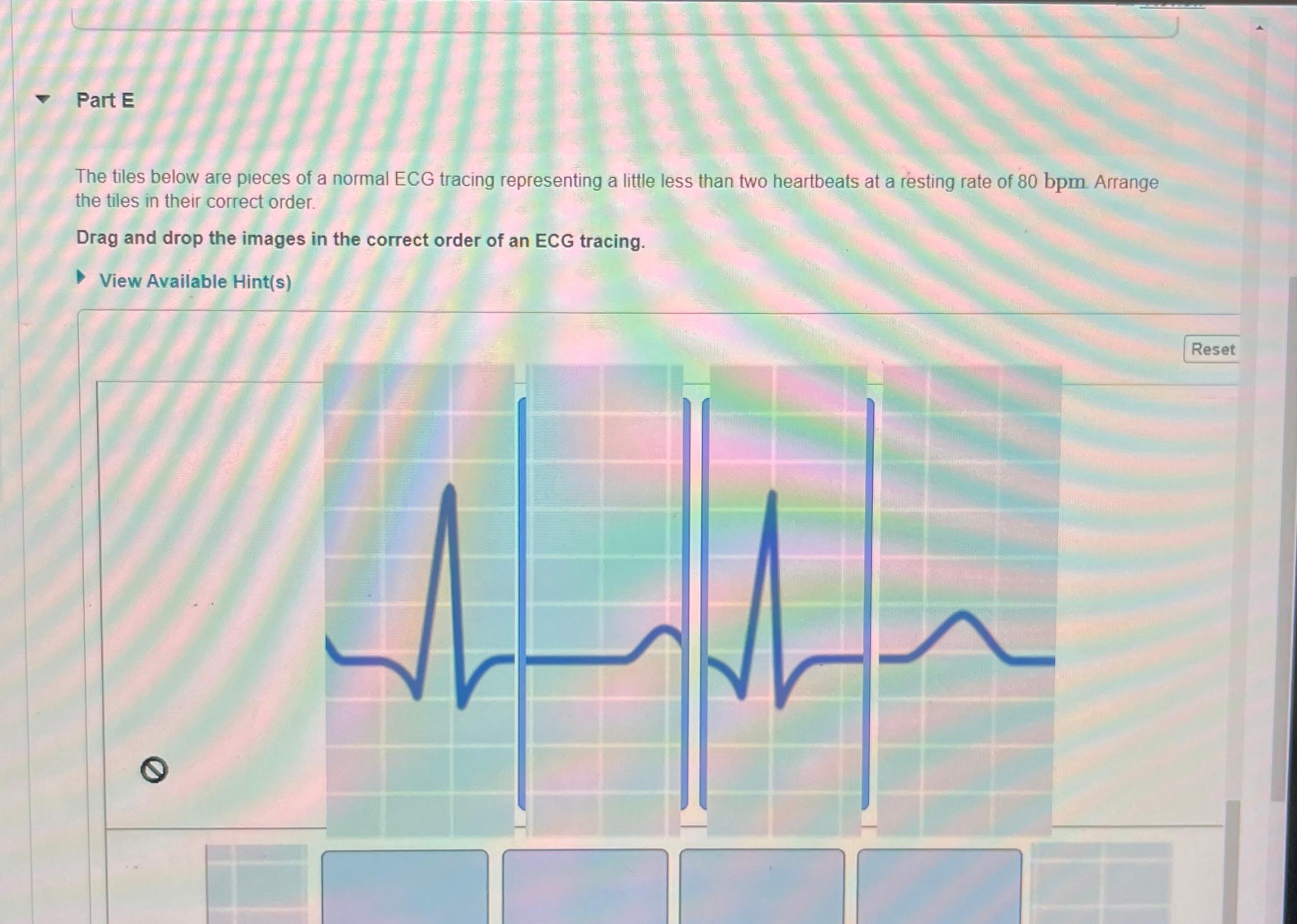Solved Part EThe tiles below are pieces of a normal ECG