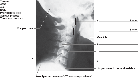 Solved: Identify the bones and features in figures 15.7 and 15