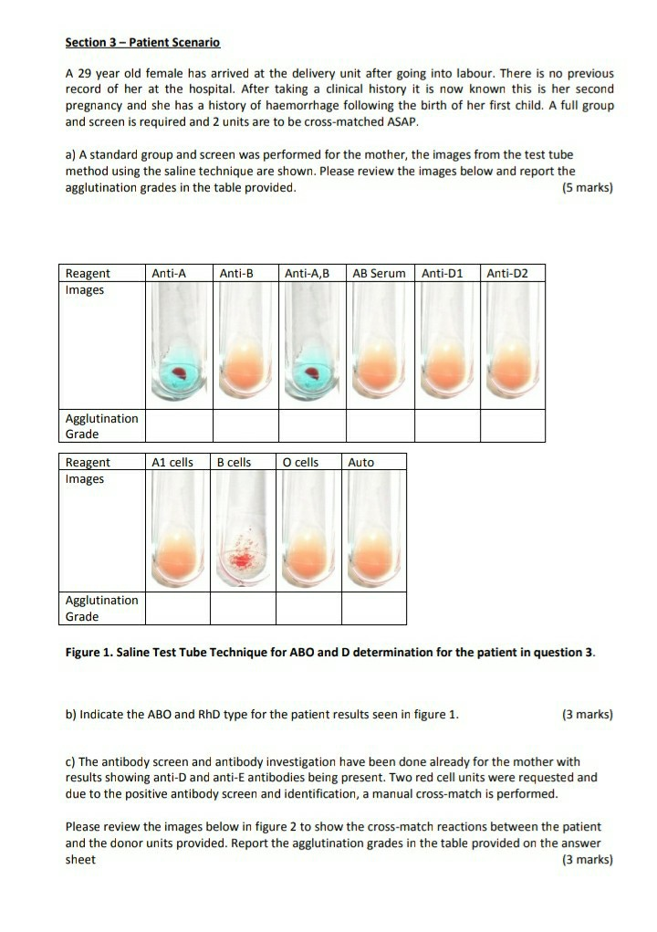 solved-c-the-antibody-screen-and-antibody-investigation-chegg