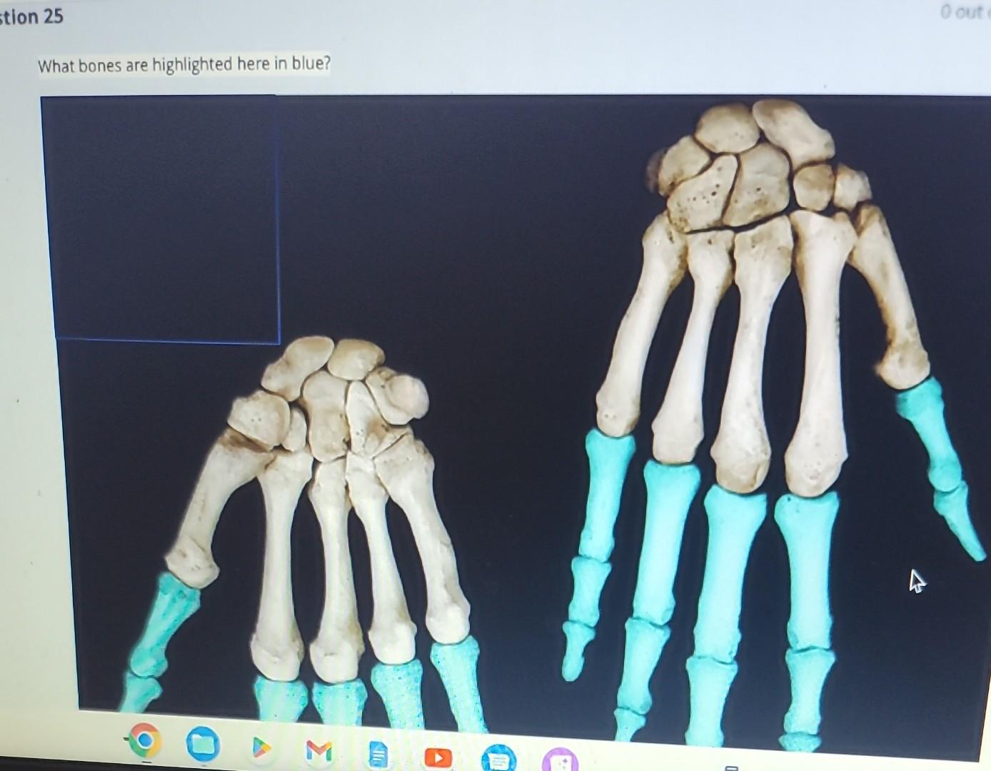 Which Bones Unite to Form the Highlighted Bone-Skeletal Fusion Explained