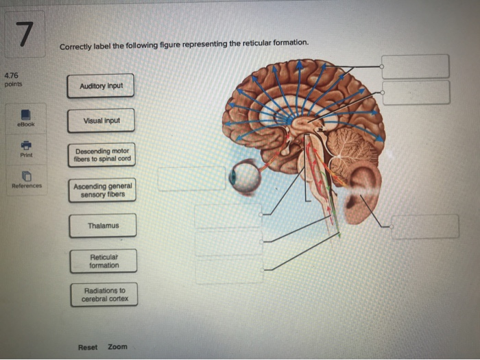 reticular formation