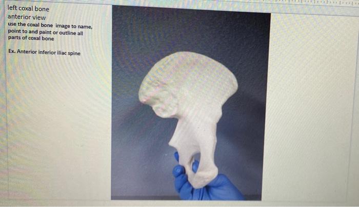 Solved Left Coxal Bone Anterior View -- name, point to and | Chegg.com