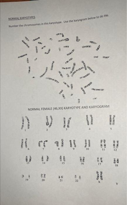 NORIMAL KARYOTYPES Number the chromosomes in this | Chegg.com