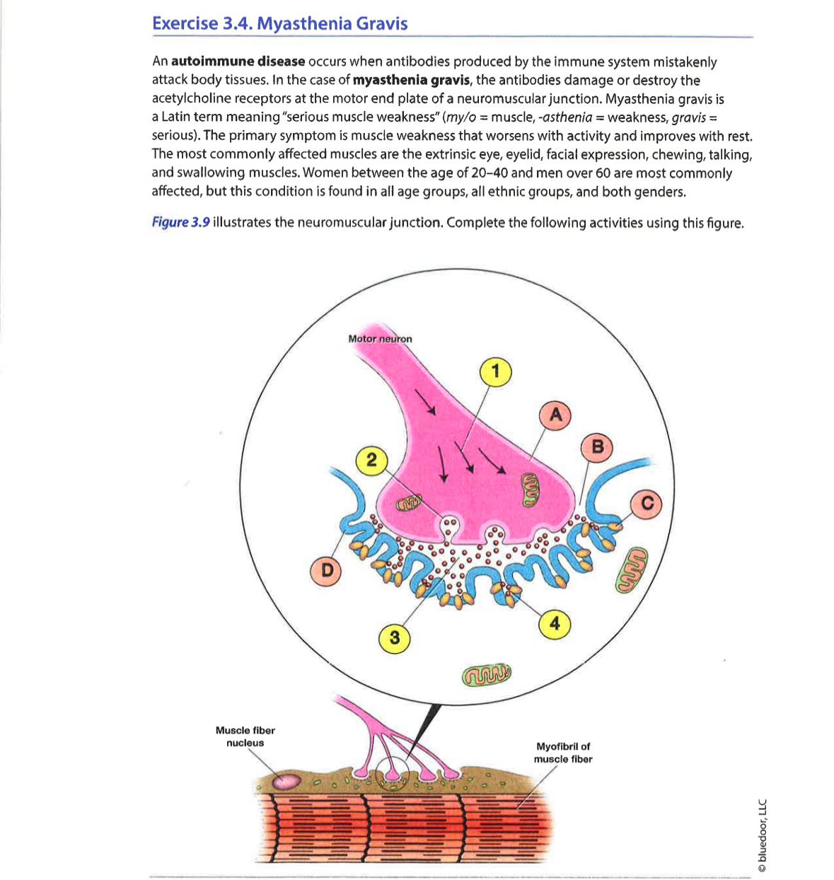 Solved Exercise 3.4. ﻿Myasthenia GravisAn autoimmune disease | Chegg.com