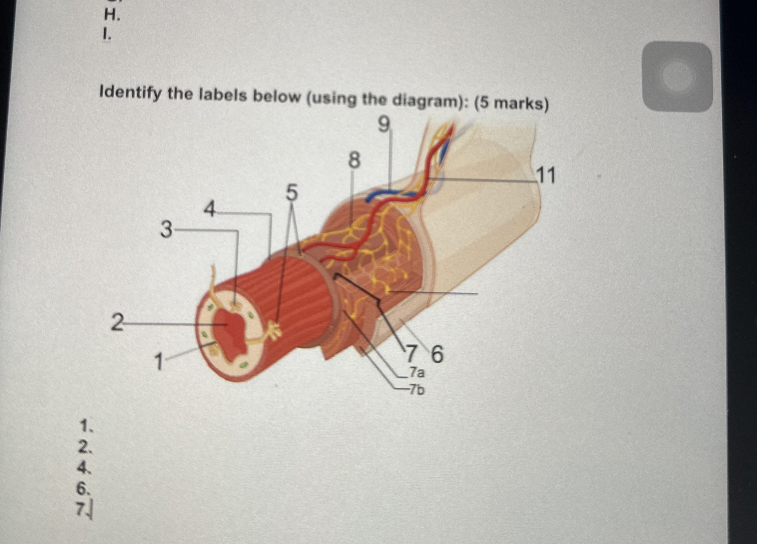 Solved H.I.Identify the labels below (using the diagram): (5 | Chegg.com