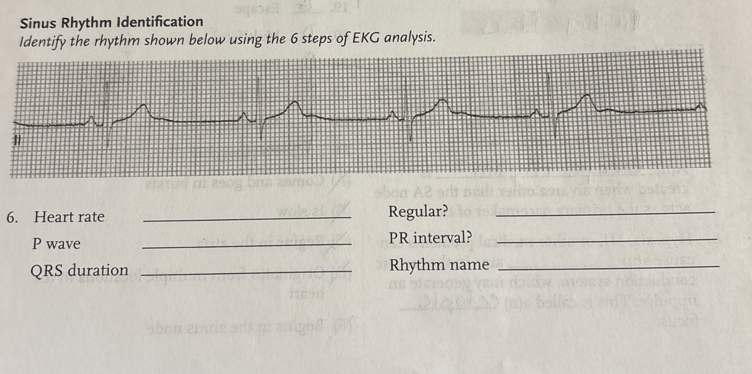 Sinus Rhythm IdentificationIdentify the rhythm shown