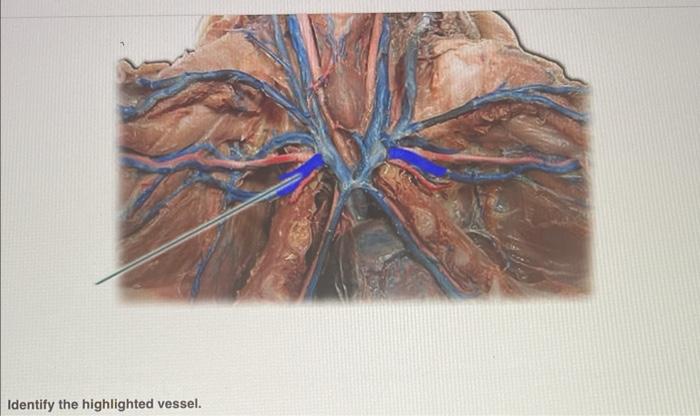 Identify the highlighted vessel.