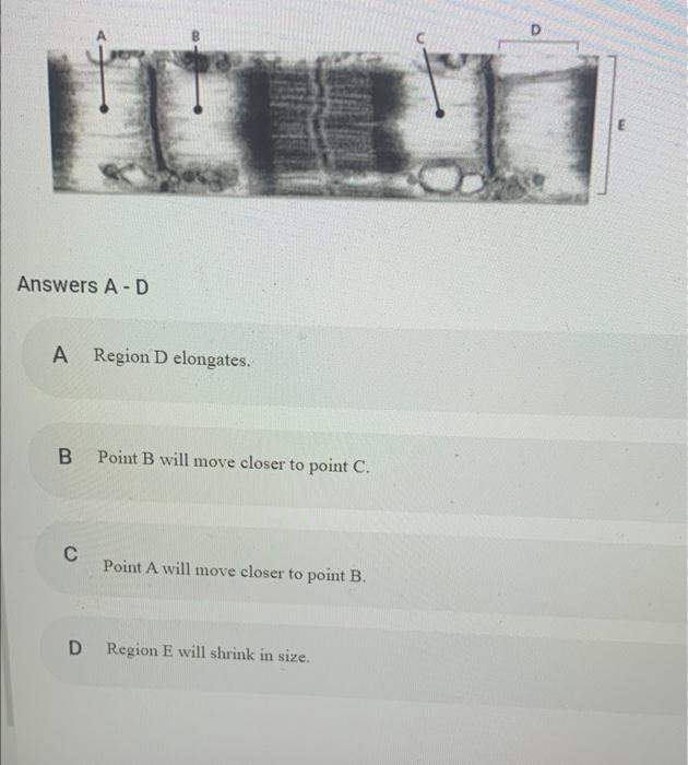 Solved the figure below shows an electron micrograph of a | Chegg.com