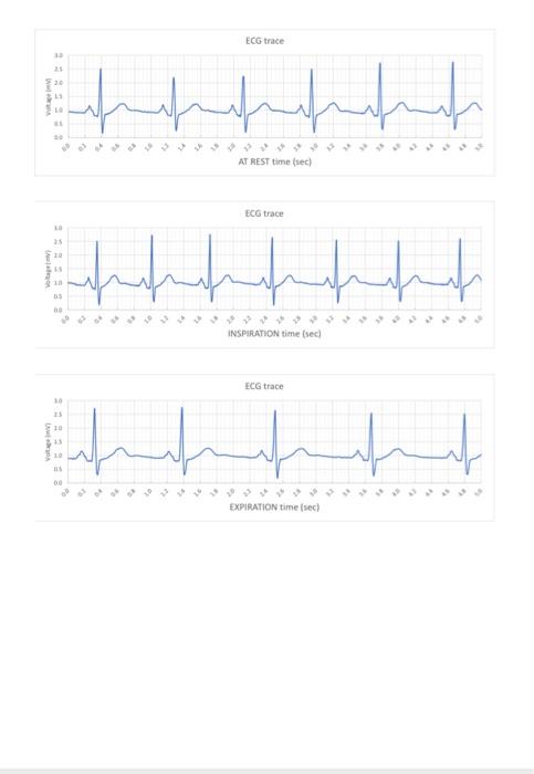 Solved TABLE 1: Average ECG measurements during the | Chegg.com