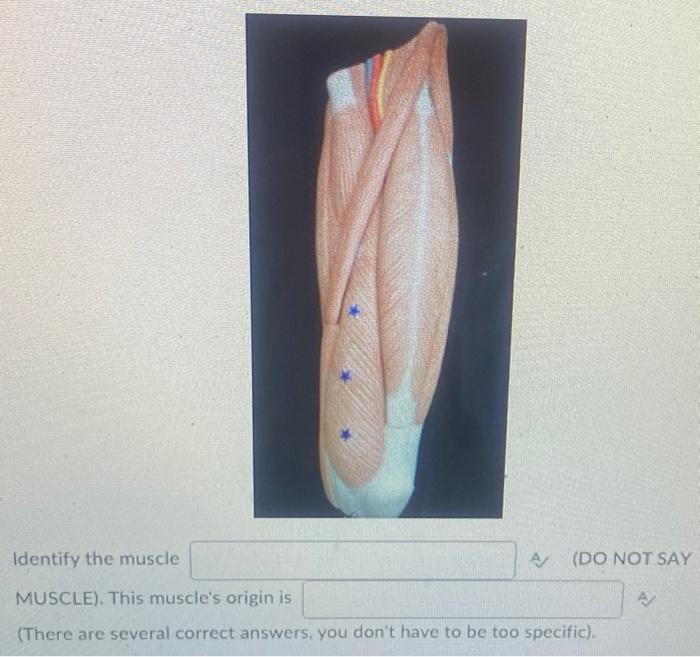 Solved Identify the muscle MUSCLE). This muscle's origin is | Chegg.com