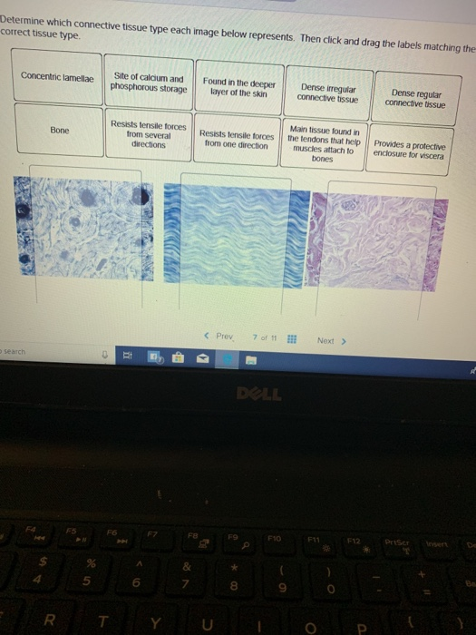 Solved ermine which connective tissue type each image below