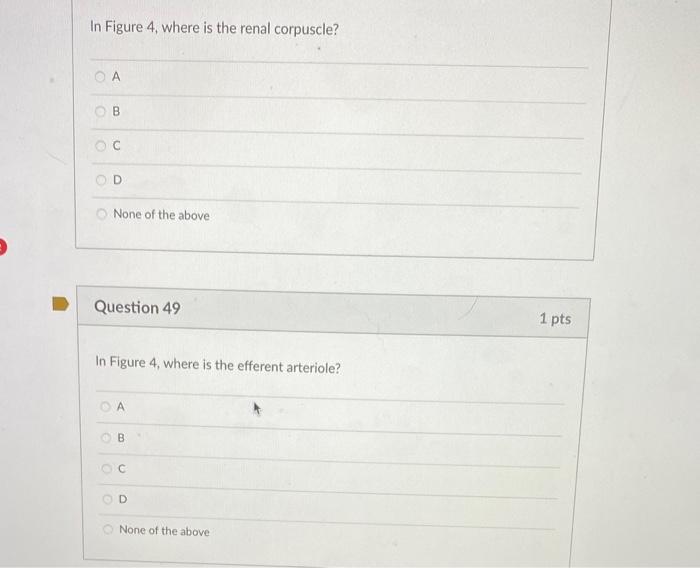 In Figure 4 , where is the renal corpuscle?
A
B
C
D.
None of the above
Question 49
\( 1 \mathrm{pts} \)
In Figure 4 , where i