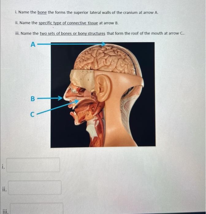 i. Name the bone the forms the superior lateral walls of the cranium at arrow A.
ii. Name the specific type of connective tis
