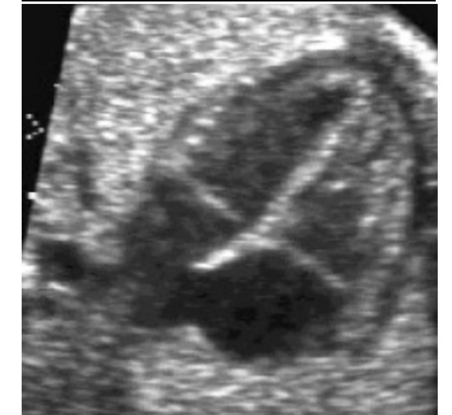 Solved Each ultrasound image has a part of the fetal Biology Diagrams