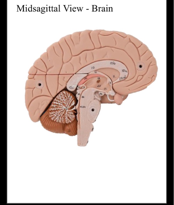 Solved Midsagittal View - Brain 106 10 10 lod 10 | Chegg.com
