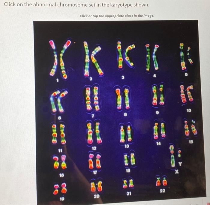 Solved Click On The Abnormal Chromosome Set In The Karyotype 