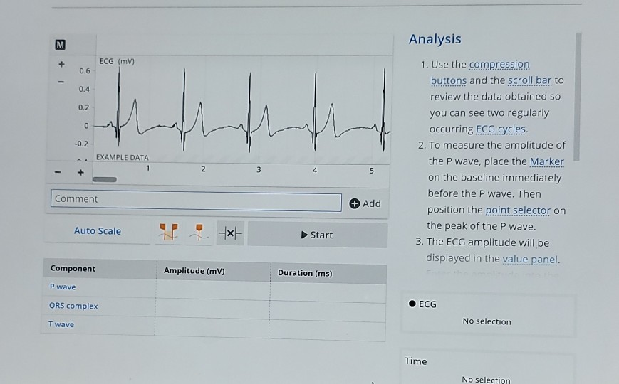 M + ECG (mv) 0.6 0.4 0.2 0 -0.2 Analysis 1. Use the | Chegg.com