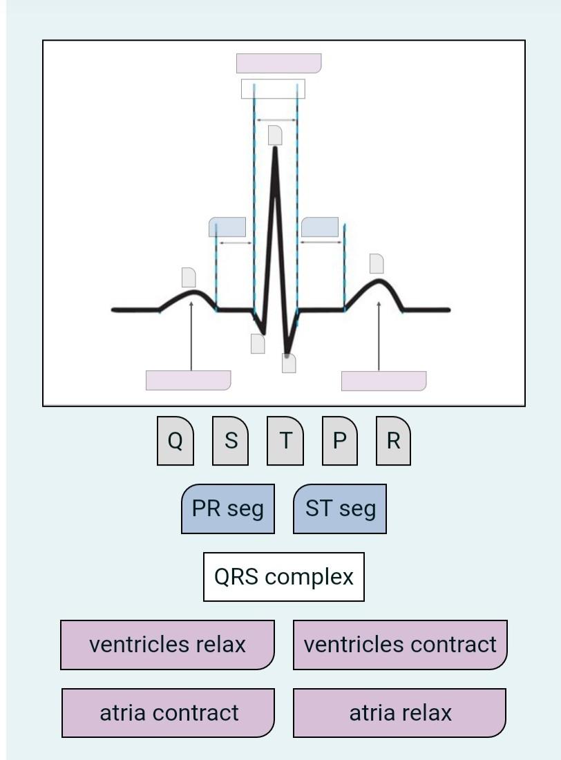 solved-ecgs-are-a-fundamental-part-of-cardiovascular-chegg