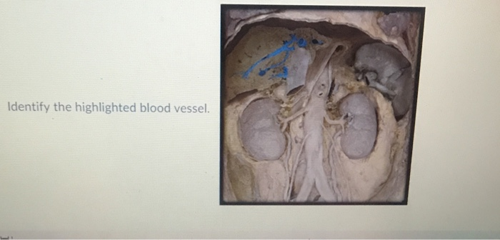 Solved Identify the highlighted blood vessel. | Chegg.com