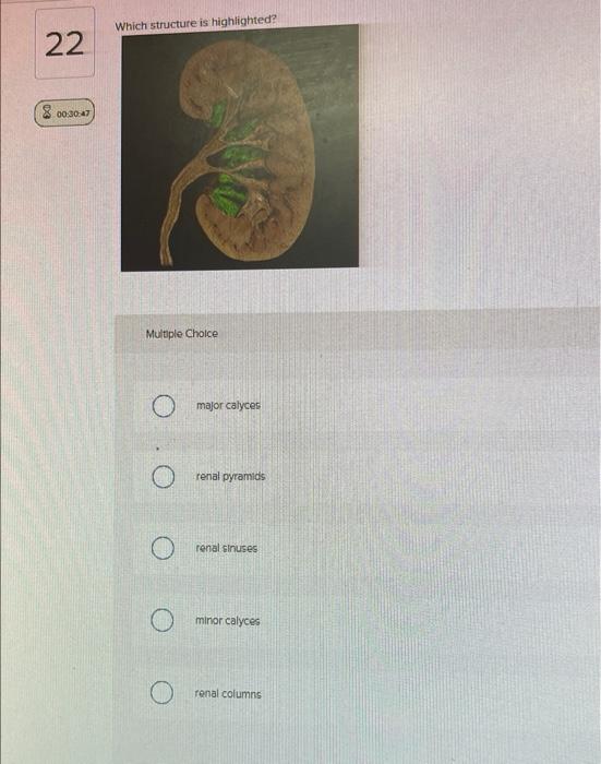 Solved Label the micrograph of the urinary bladder using the | Chegg.com