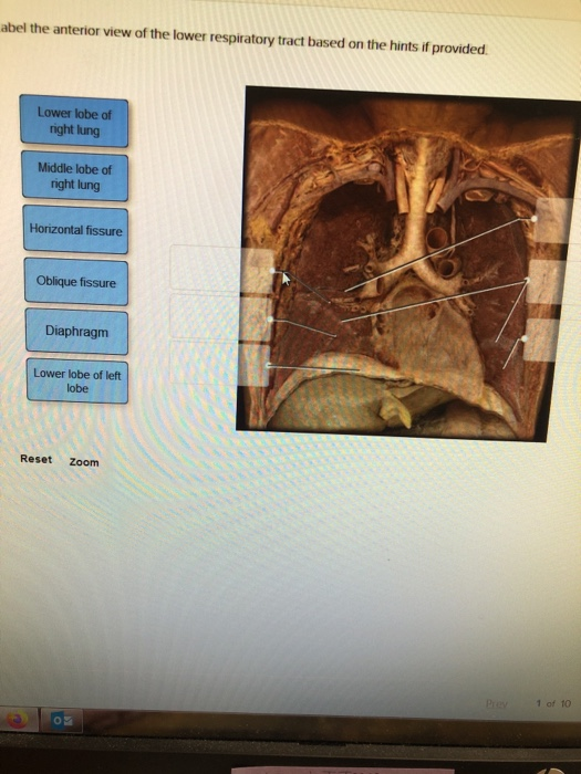Solved abel the anterior view of the lower respiratory tract | Chegg.com