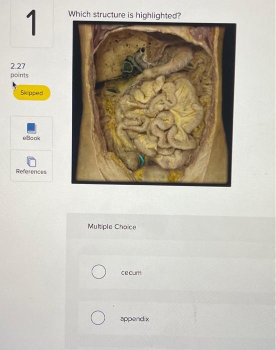 Solved Which Structure Is Highlighted? 1 2.27 Points Skipped | Chegg.com