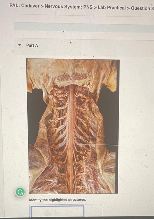 PAL: Cadaver > Nervous System: PNS > Lab Practical > Question 8
Part A
Identify the highlighted structures.