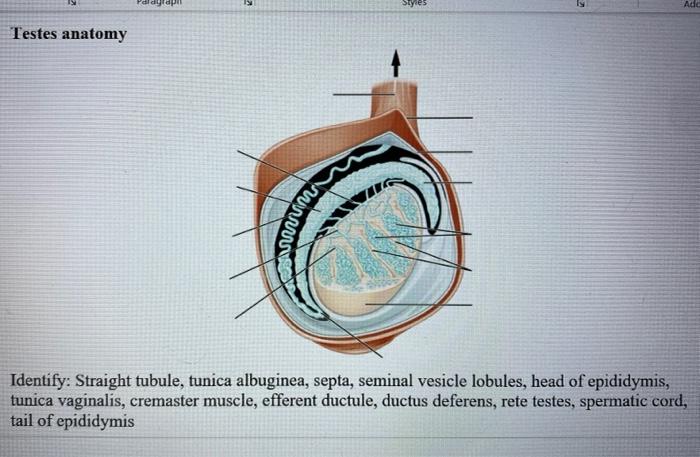 Solved Testes anatomy Identify: Straight tubule, tunica | Chegg.com