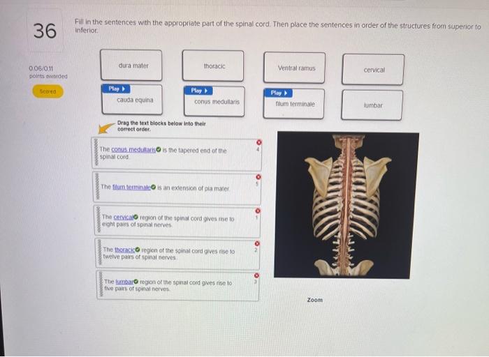 Solved Muligle Choice socral region conus medullaris | Chegg.com