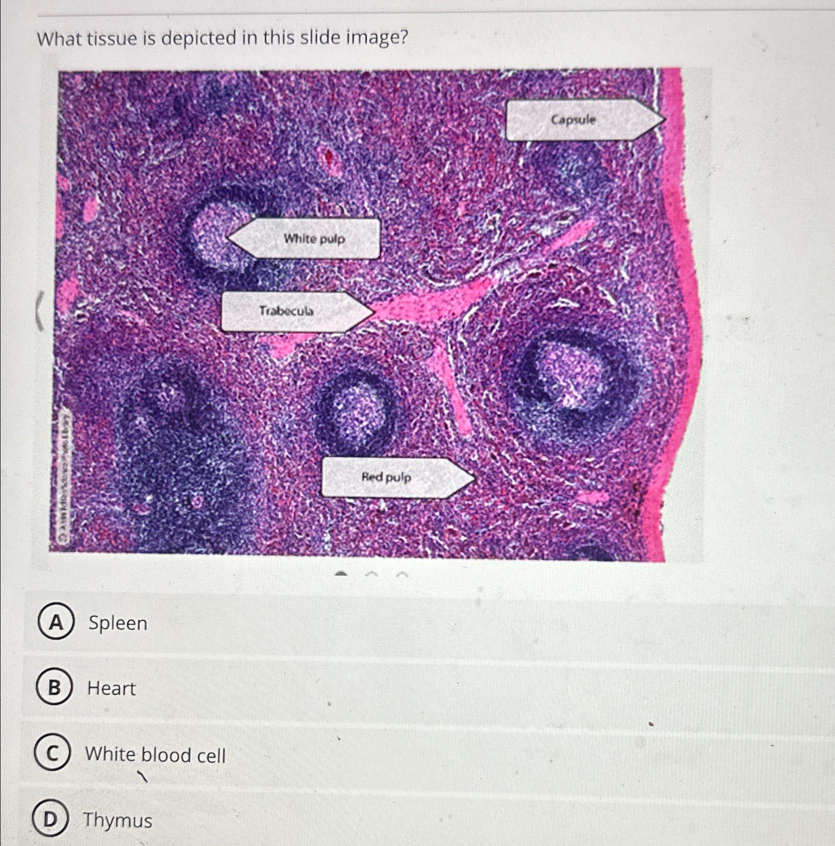 Solved What tissue is depicted in this slide | Chegg.com