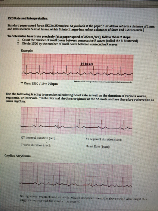 Solved EKG Rate and Interpretation Standard paper speed for | Chegg.com