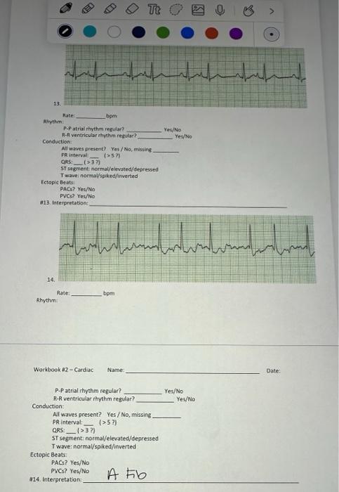 Solved 13. Rhythm: Rate: bpm P-P atrial rhythm regular? R-R | Chegg.com