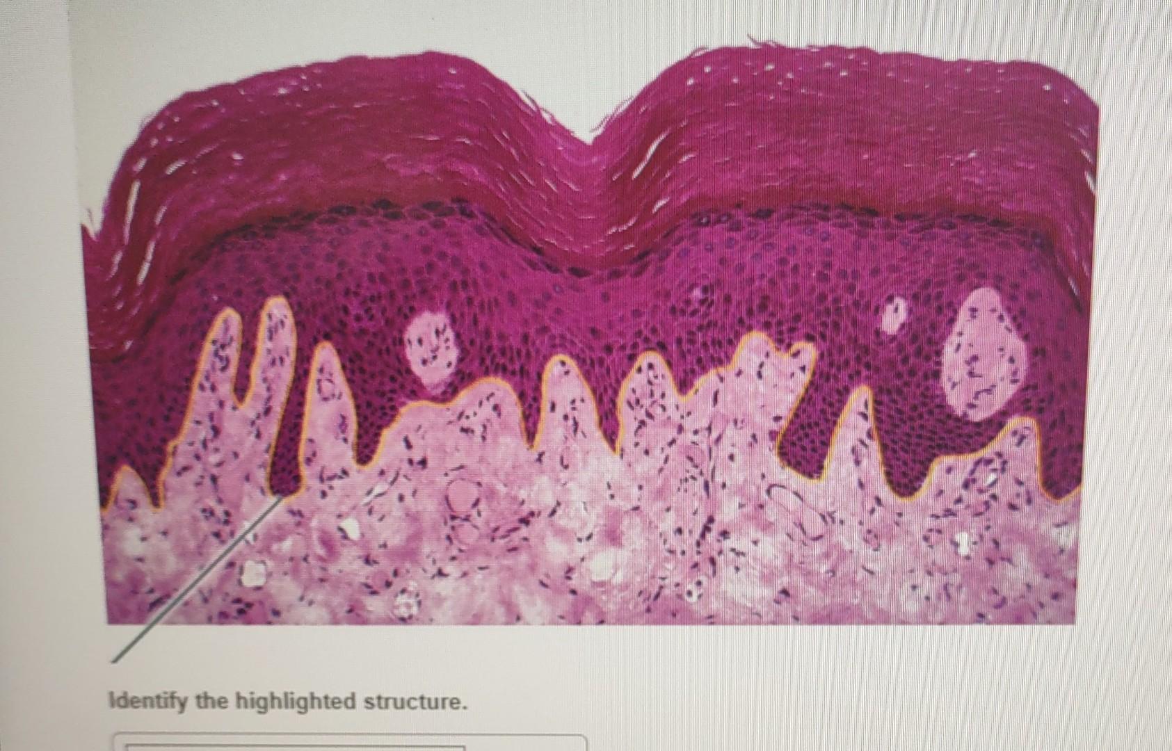 Solved Identify the highlighted structure. | Chegg.com