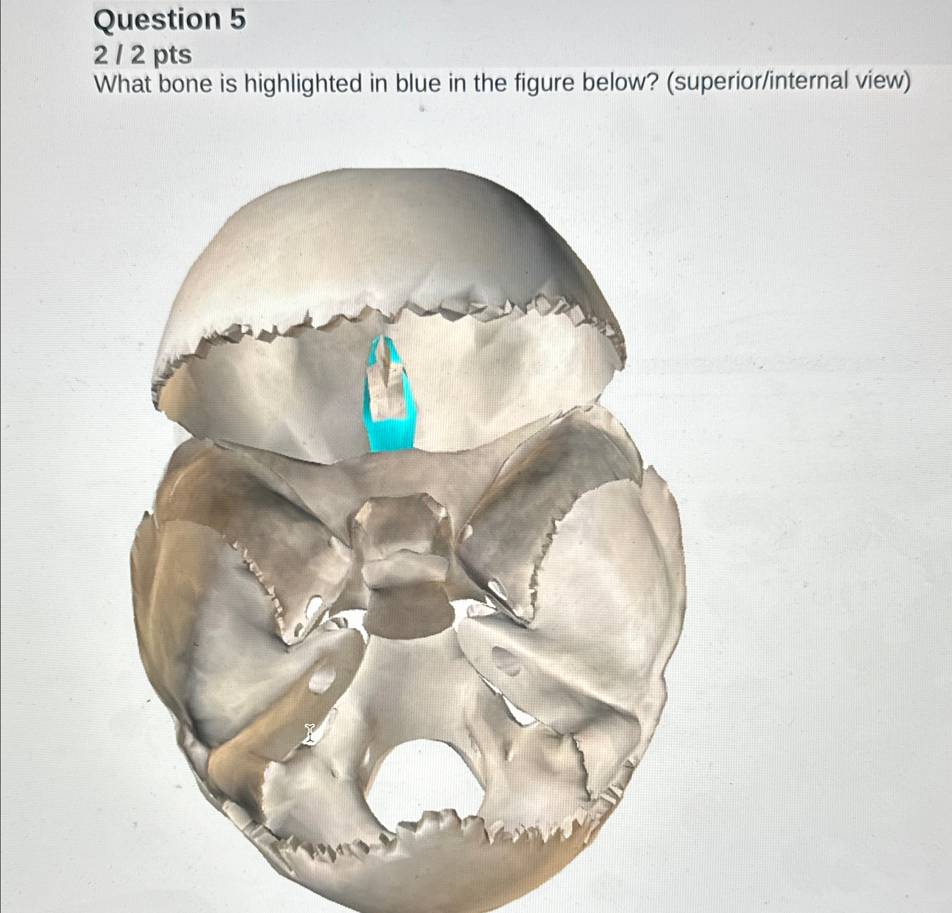 Solved Question 52 / 2 ﻿pts What bone is highlighted in blue | Chegg.com