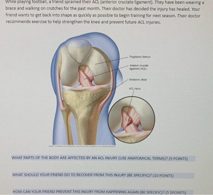 Solved While playing football, a friend sprained their ACL