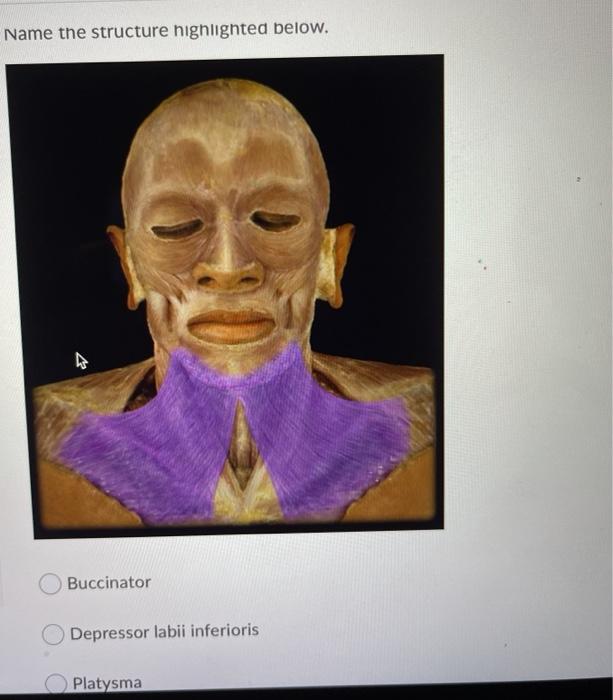 Solved Name the highlighted structure below. Orbicularis Chegg