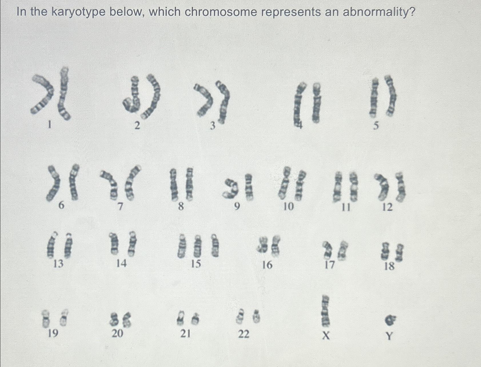 Solved In the karyotype below which cheomosome representa an | Chegg.com