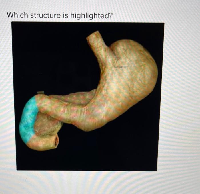 Solved Which structure is hiahliahted? horizontal part of | Chegg.com
