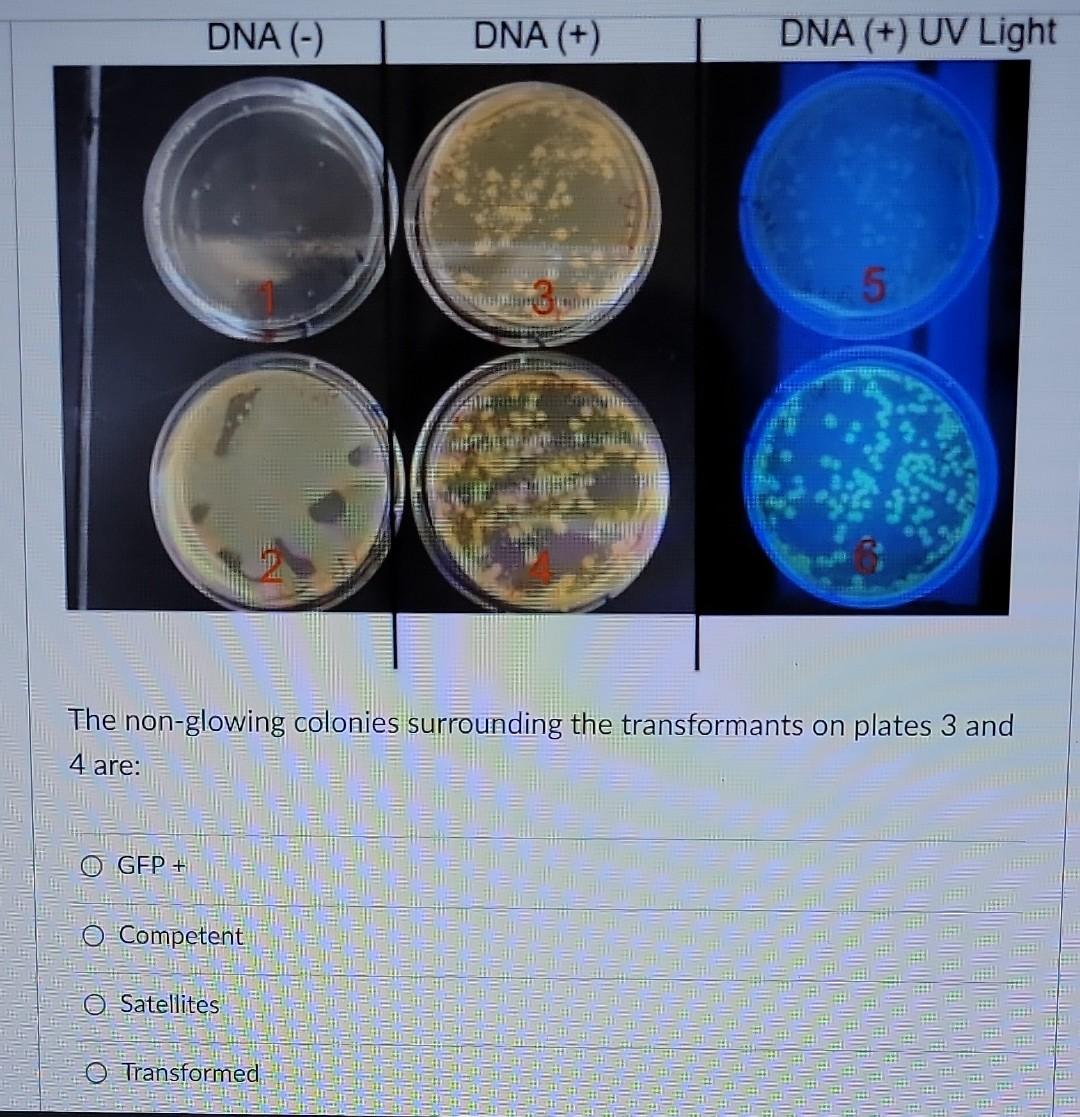 Solved DNA (-) DNA (+) DNA (+) UV Light 5 LI mit The | Chegg.com