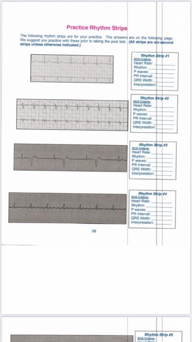 Practice Rhythm Strips The following rhythm strips | Chegg.com