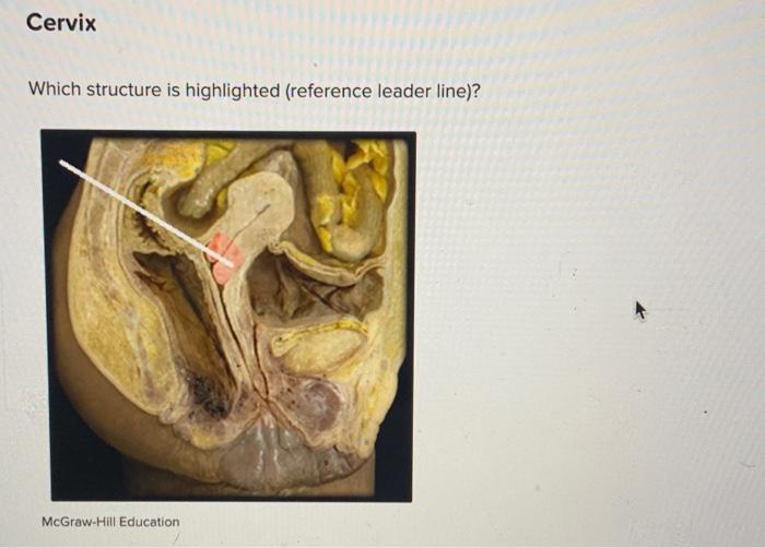 Which structure is highlighted (reference leader line)?