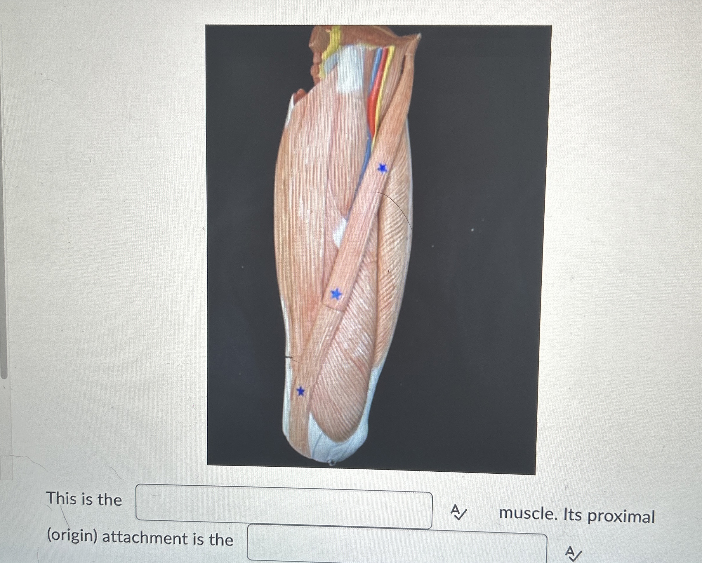 Solved This is the muscle. Its proximal (origin) ﻿attachment | Chegg.com